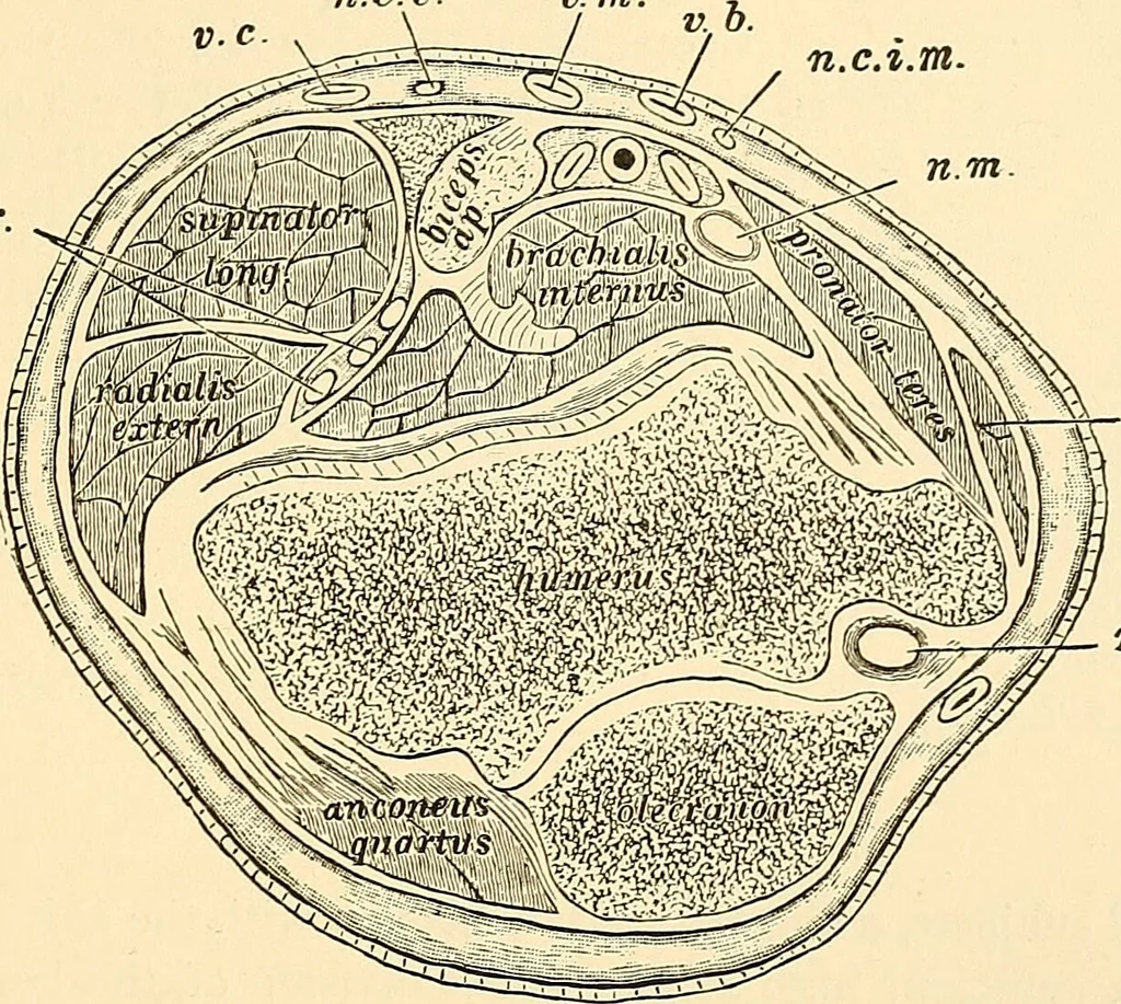 An illustration from Surgical technic; a text-book on operative surgery / by Fr. von Esmarch ... and E. Kowalzig ... translated by Professor Ludwig H. Grau ... and Willam N. Sullivan ... edited by Nicholas Senn ... With fourteen hundred and ninety-seven illustrations and fifteen colored plates., 1901, leaf 415