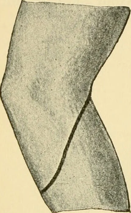 An illustration from Surgical technic; a text-book on operative surgery / by Fr. von Esmarch ... and E. Kowalzig ... translated by Professor Ludwig H. Grau ... and Willam N. Sullivan ... edited by Nicholas Senn ... With fourteen hundred and ninety-seven illustrations and fifteen colored plates., 1901, leaf 416