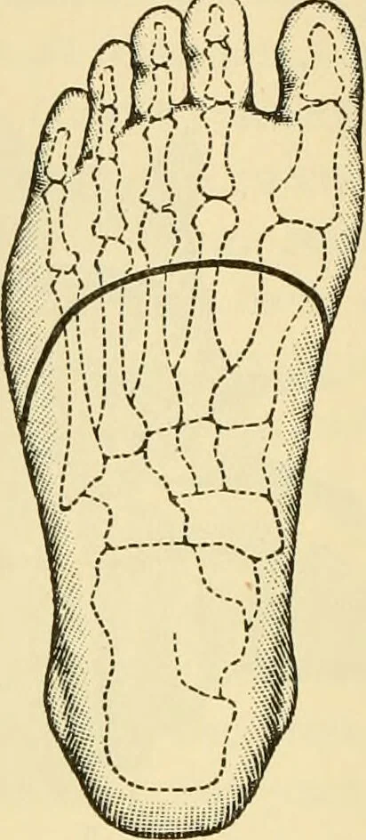 An illustration from Surgical technic; a text-book on operative surgery / by Fr. von Esmarch ... and E. Kowalzig ... translated by Professor Ludwig H. Grau ... and Willam N. Sullivan ... edited by Nicholas Senn ... With fourteen hundred and ninety-seven illustrations and fifteen colored plates., 1901, leaf 430