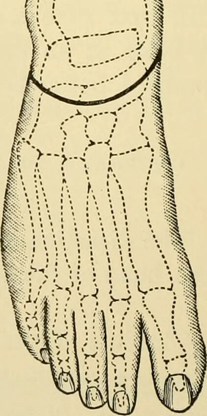 An illustration from Surgical technic; a text-book on operative surgery / by Fr. von Esmarch ... and E. Kowalzig ... translated by Professor Ludwig H. Grau ... and Willam N. Sullivan ... edited by Nicholas Senn ... With fourteen hundred and ninety-seven illustrations and fifteen colored plates., 1901, leaf 430
