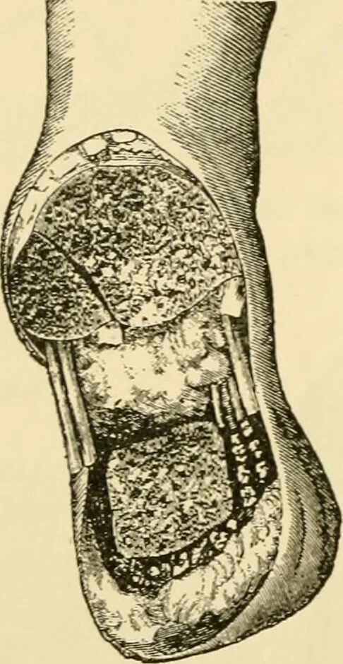 An illustration from Surgical technic; a text-book on operative surgery / by Fr. von Esmarch ... and E. Kowalzig ... translated by Professor Ludwig H. Grau ... and Willam N. Sullivan ... edited by Nicholas Senn ... With fourteen hundred and ninety-seven illustrations and fifteen colored plates., 1901, leaf 438