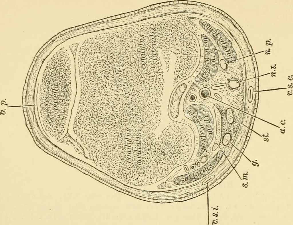 An illustration from Surgical technic; a text-book on operative surgery / by Fr. von Esmarch ... and E. Kowalzig ... translated by Professor Ludwig H. Grau ... and Willam N. Sullivan ... edited by Nicholas Senn ... With fourteen hundred and ninety-seven illustrations and fifteen colored plates., 1901, leaf 448