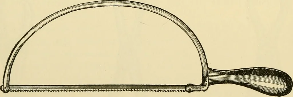 An illustration from Surgical technic; a text-book on operative surgery / by Fr. von Esmarch ... and E. Kowalzig ... translated by Professor Ludwig H. Grau ... and Willam N. Sullivan ... edited by Nicholas Senn ... With fourteen hundred and ninety-seven illustrations and fifteen colored plates., 1901, leaf 468