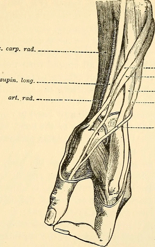 An illustration from Surgical technic; a text-book on operative surgery / by Fr. von Esmarch ... and E. Kowalzig ... translated by Professor Ludwig H. Grau ... and Willam N. Sullivan ... edited by Nicholas Senn ... With fourteen hundred and ninety-seven illustrations and fifteen colored plates., 1901, leaf 473