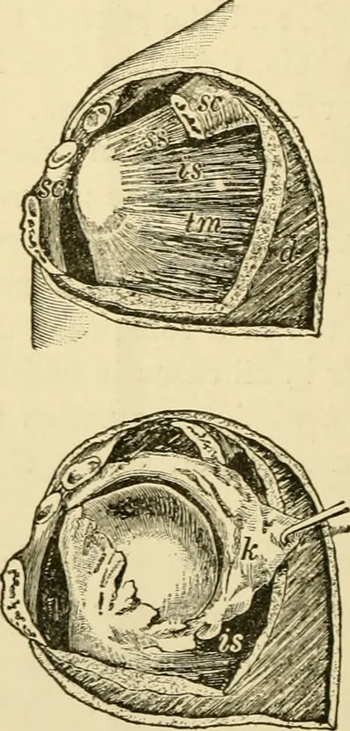 An illustration from Surgical technic; a text-book on operative surgery / by Fr. von Esmarch ... and E. Kowalzig ... translated by Professor Ludwig H. Grau ... and Willam N. Sullivan ... edited by Nicholas Senn ... With fourteen hundred and ninety-seven illustrations and fifteen colored plates., 1901, leaf 492