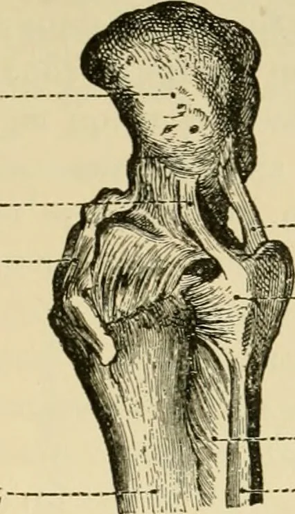An illustration from Surgical technic; a text-book on operative surgery / by Fr. von Esmarch ... and E. Kowalzig ... translated by Professor Ludwig H. Grau ... and Willam N. Sullivan ... edited by Nicholas Senn ... With fourteen hundred and ninety-seven illustrations and fifteen colored plates., 1901, leaf 498