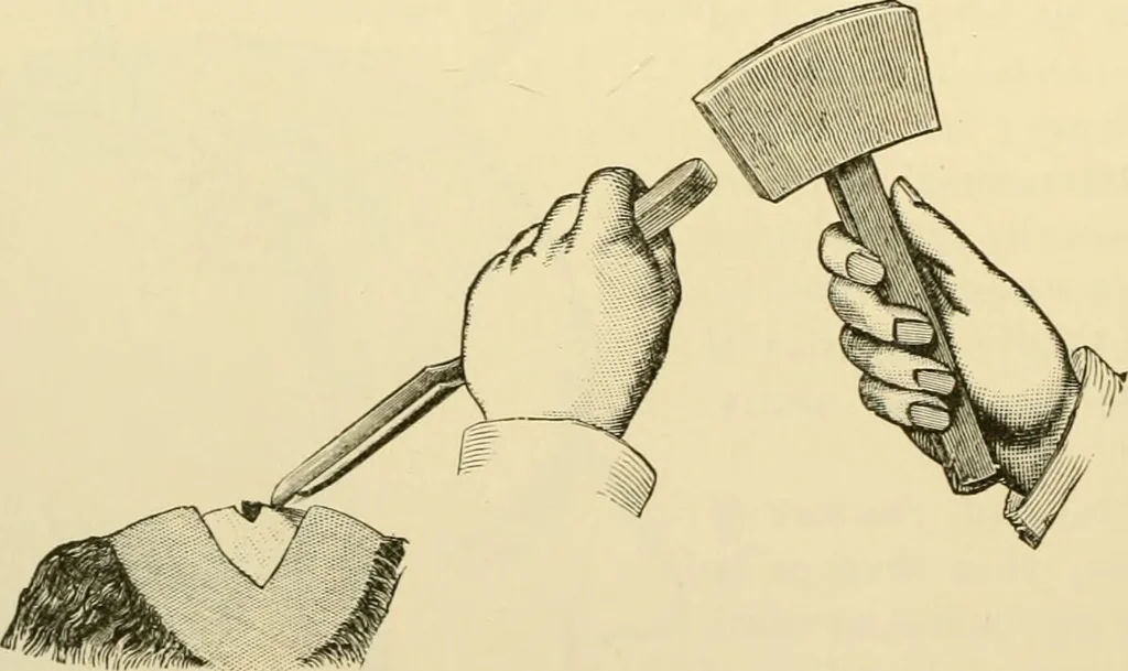 An illustration from Surgical technic; a text-book on operative surgery / by Fr. von Esmarch ... and E. Kowalzig ... translated by Professor Ludwig H. Grau ... and Willam N. Sullivan ... edited by Nicholas Senn ... With fourteen hundred and ninety-seven illustrations and fifteen colored plates., 1901, leaf 532