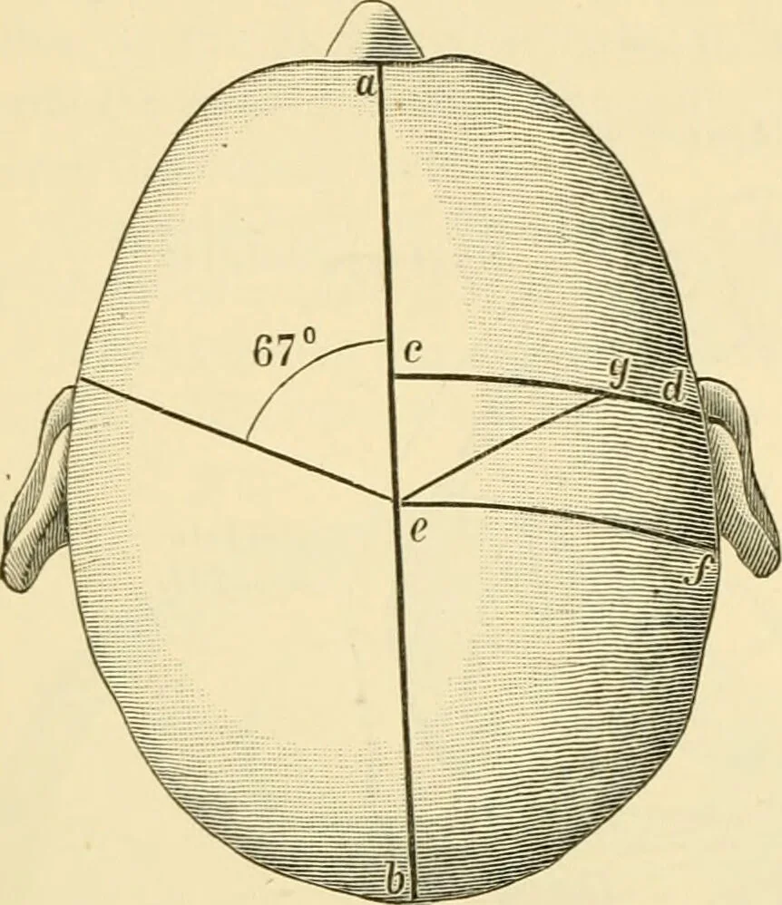 An illustration from Surgical technic; a text-book on operative surgery / by Fr. von Esmarch ... and E. Kowalzig ... translated by Professor Ludwig H. Grau ... and Willam N. Sullivan ... edited by Nicholas Senn ... With fourteen hundred and ninety-seven illustrations and fifteen colored plates., 1901, leaf 542