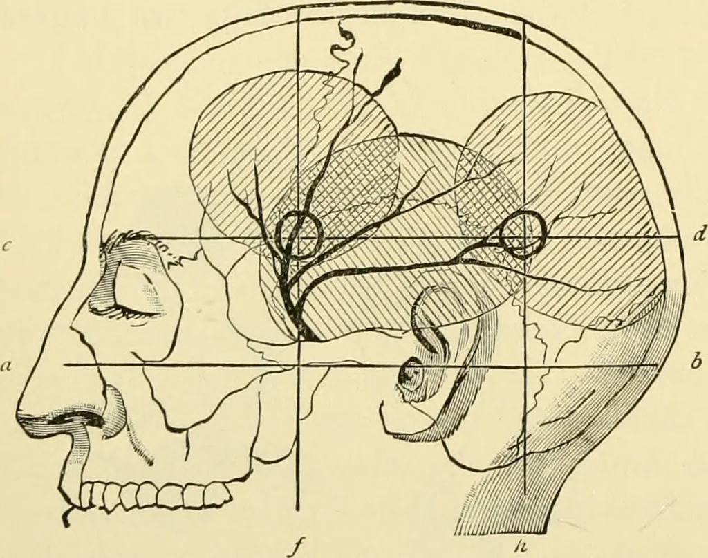 An illustration from Surgical technic; a text-book on operative surgery / by Fr. von Esmarch ... and E. Kowalzig ... translated by Professor Ludwig H. Grau ... and Willam N. Sullivan ... edited by Nicholas Senn ... With fourteen hundred and ninety-seven illustrations and fifteen colored plates., 1901, leaf 548