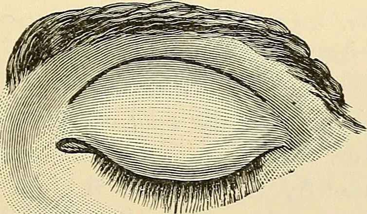 An illustration from Surgical technic; a text-book on operative surgery / by Fr. von Esmarch ... and E. Kowalzig ... translated by Professor Ludwig H. Grau ... and Willam N. Sullivan ... edited by Nicholas Senn ... With fourteen hundred and ninety-seven illustrations and fifteen colored plates., 1901, leaf 571