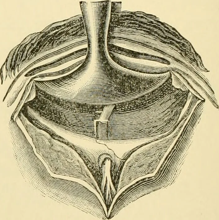 An illustration from Surgical technic; a text-book on operative surgery / by Fr. von Esmarch ... and E. Kowalzig ... translated by Professor Ludwig H. Grau ... and Willam N. Sullivan ... edited by Nicholas Senn ... With fourteen hundred and ninety-seven illustrations and fifteen colored plates., 1901, leaf 572