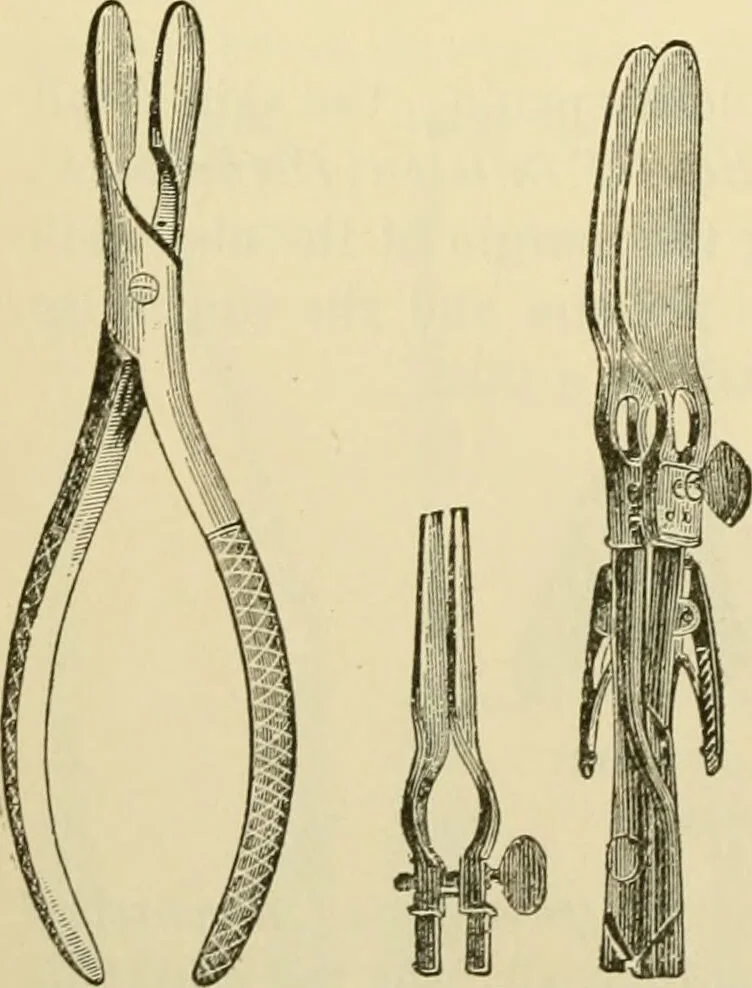 An illustration from Surgical technic; a text-book on operative surgery / by Fr. von Esmarch ... and E. Kowalzig ... translated by Professor Ludwig H. Grau ... and Willam N. Sullivan ... edited by Nicholas Senn ... With fourteen hundred and ninety-seven illustrations and fifteen colored plates., 1901, leaf 656