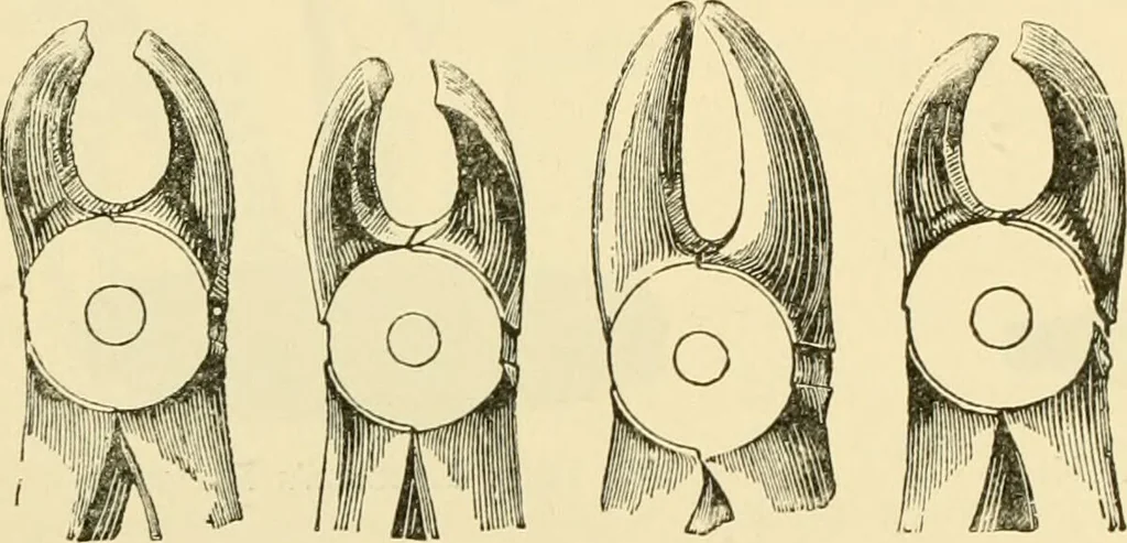An illustration from Surgical technic; a text-book on operative surgery / by Fr. von Esmarch ... and E. Kowalzig ... translated by Professor Ludwig H. Grau ... and Willam N. Sullivan ... edited by Nicholas Senn ... With fourteen hundred and ninety-seven illustrations and fifteen colored plates., 1901, leaf 662
