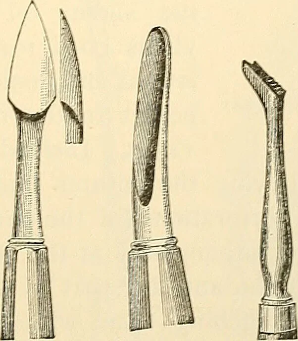 An illustration from Surgical technic; a text-book on operative surgery / by Fr. von Esmarch ... and E. Kowalzig ... translated by Professor Ludwig H. Grau ... and Willam N. Sullivan ... edited by Nicholas Senn ... With fourteen hundred and ninety-seven illustrations and fifteen colored plates., 1901, leaf 665