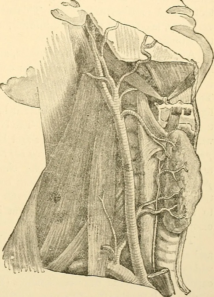 An illustration from Surgical technic; a text-book on operative surgery / by Fr. von Esmarch ... and E. Kowalzig ... translated by Professor Ludwig H. Grau ... and Willam N. Sullivan ... edited by Nicholas Senn ... With fourteen hundred and ninety-seven illustrations and fifteen colored plates., 1901, leaf 705