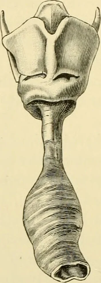 An illustration from Surgical technic; a text-book on operative surgery / by Fr. von Esmarch ... and E. Kowalzig ... translated by Professor Ludwig H. Grau ... and Willam N. Sullivan ... edited by Nicholas Senn ... With fourteen hundred and ninety-seven illustrations and fifteen colored plates., 1901, leaf 710