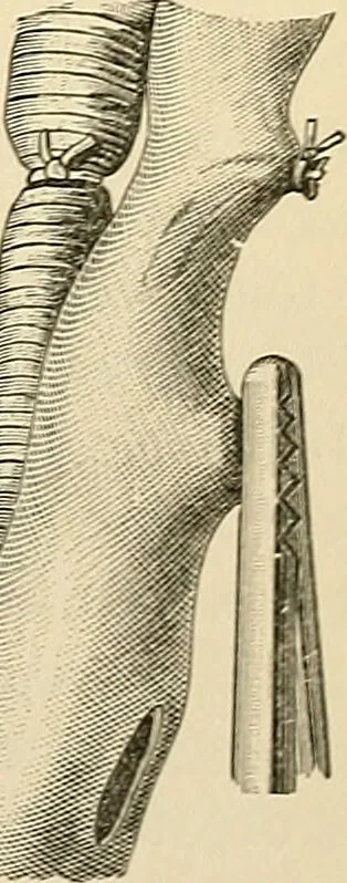 An illustration from Surgical technic; a text-book on operative surgery / by Fr. von Esmarch ... and E. Kowalzig ... translated by Professor Ludwig H. Grau ... and Willam N. Sullivan ... edited by Nicholas Senn ... With fourteen hundred and ninety-seven illustrations and fifteen colored plates., 1901, leaf 725