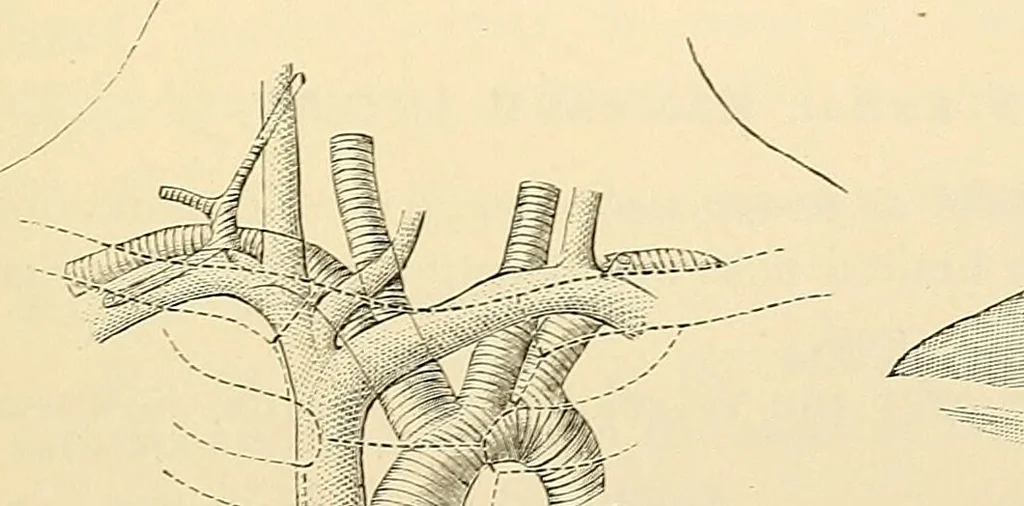 An illustration from Surgical technic; a text-book on operative surgery / by Fr. von Esmarch ... and E. Kowalzig ... translated by Professor Ludwig H. Grau ... and Willam N. Sullivan ... edited by Nicholas Senn ... With fourteen hundred and ninety-seven illustrations and fifteen colored plates., 1901, leaf 727