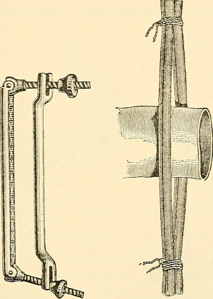 An illustration from Surgical technic; a text-book on operative surgery / by Fr. von Esmarch ... and E. Kowalzig ... translated by Professor Ludwig H. Grau ... and Willam N. Sullivan ... edited by Nicholas Senn ... With fourteen hundred and ninety-seven illustrations and fifteen colored plates., 1901, leaf 763