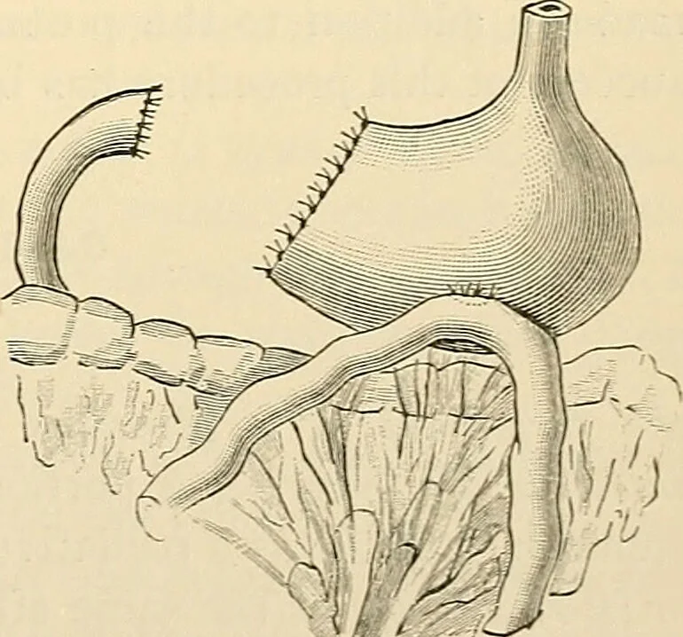 An illustration from Surgical technic; a text-book on operative surgery / by Fr. von Esmarch ... and E. Kowalzig ... translated by Professor Ludwig H. Grau ... and Willam N. Sullivan ... edited by Nicholas Senn ... With fourteen hundred and ninety-seven illustrations and fifteen colored plates., 1901, leaf 765