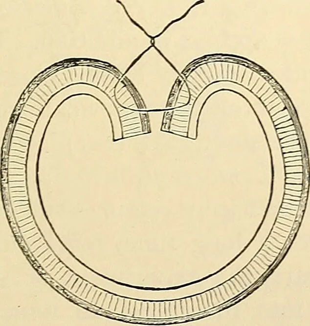 An illustration from Surgical technic; a text-book on operative surgery / by Fr. von Esmarch ... and E. Kowalzig ... translated by Professor Ludwig H. Grau ... and Willam N. Sullivan ... edited by Nicholas Senn ... With fourteen hundred and ninety-seven illustrations and fifteen colored plates., 1901, leaf 779