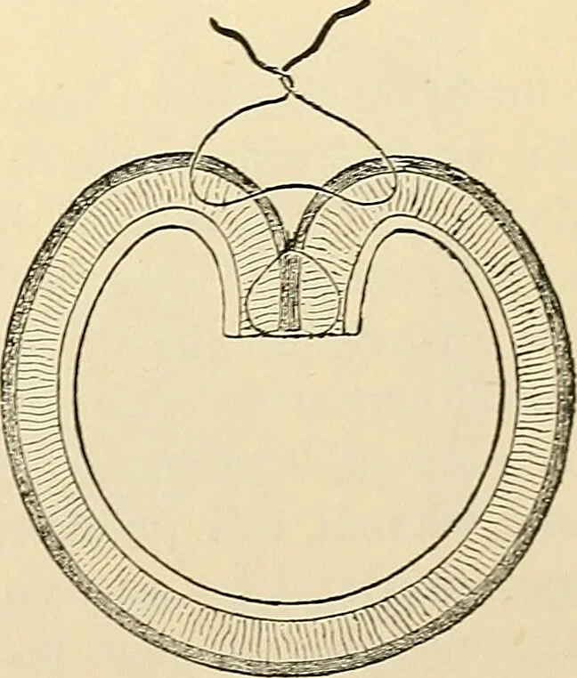 An illustration from Surgical technic; a text-book on operative surgery / by Fr. von Esmarch ... and E. Kowalzig ... translated by Professor Ludwig H. Grau ... and Willam N. Sullivan ... edited by Nicholas Senn ... With fourteen hundred and ninety-seven illustrations and fifteen colored plates., 1901, leaf 779