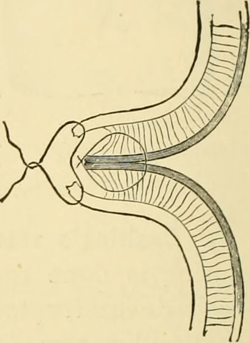 An illustration from Surgical technic; a text-book on operative surgery / by Fr. von Esmarch ... and E. Kowalzig ... translated by Professor Ludwig H. Grau ... and Willam N. Sullivan ... edited by Nicholas Senn ... With fourteen hundred and ninety-seven illustrations and fifteen colored plates., 1901, leaf 780