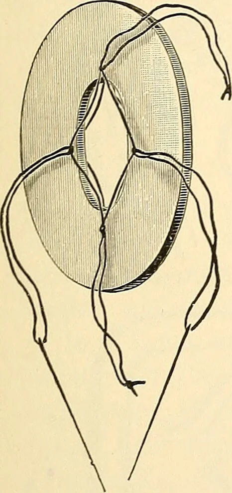 An illustration from Surgical technic; a text-book on operative surgery / by Fr. von Esmarch ... and E. Kowalzig ... translated by Professor Ludwig H. Grau ... and Willam N. Sullivan ... edited by Nicholas Senn ... With fourteen hundred and ninety-seven illustrations and fifteen colored plates., 1901, leaf 785
