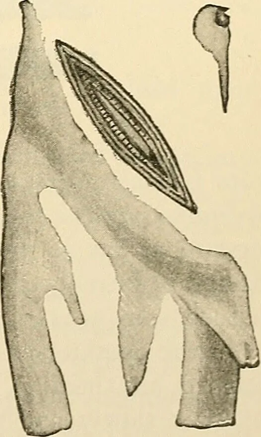 An illustration from Surgical technic; a text-book on operative surgery / by Fr. von Esmarch ... and E. Kowalzig ... translated by Professor Ludwig H. Grau ... and Willam N. Sullivan ... edited by Nicholas Senn ... With fourteen hundred and ninety-seven illustrations and fifteen colored plates., 1901, leaf 787