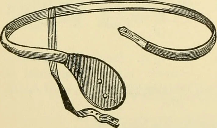 An illustration from Surgical technic; a text-book on operative surgery / by Fr. von Esmarch ... and E. Kowalzig ... translated by Professor Ludwig H. Grau ... and Willam N. Sullivan ... edited by Nicholas Senn ... With fourteen hundred and ninety-seven illustrations and fifteen colored plates., 1901, leaf 790