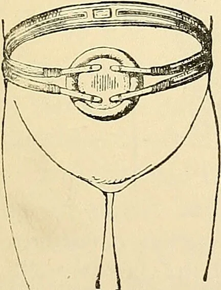 An illustration from Surgical technic; a text-book on operative surgery / by Fr. von Esmarch ... and E. Kowalzig ... translated by Professor Ludwig H. Grau ... and Willam N. Sullivan ... edited by Nicholas Senn ... With fourteen hundred and ninety-seven illustrations and fifteen colored plates., 1901, leaf 791