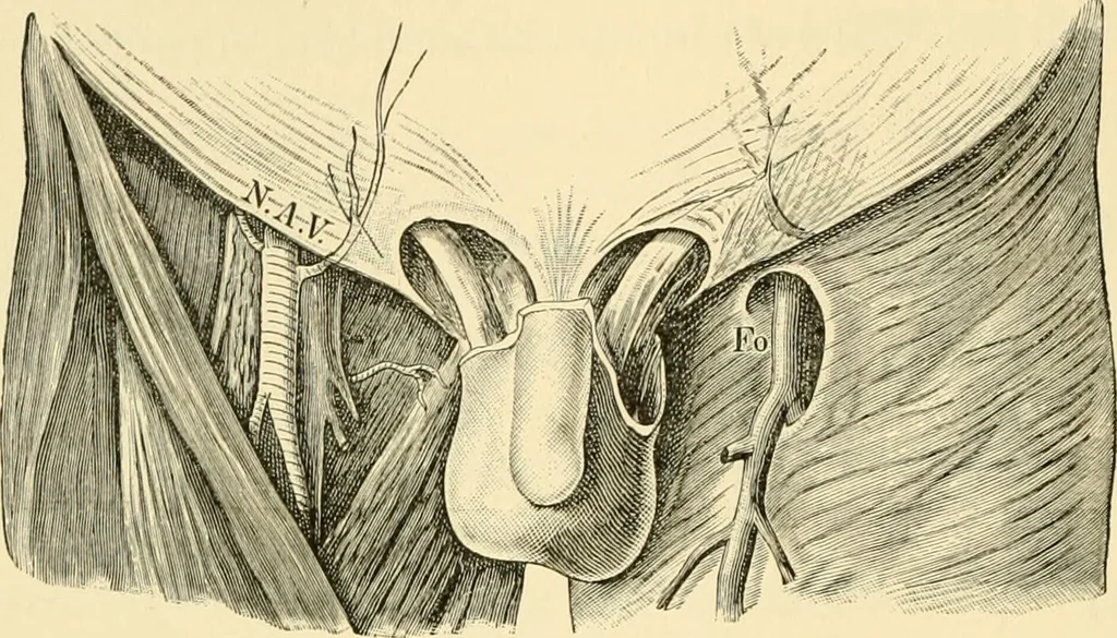 An illustration from Surgical technic; a text-book on operative surgery / by Fr. von Esmarch ... and E. Kowalzig ... translated by Professor Ludwig H. Grau ... and Willam N. Sullivan ... edited by Nicholas Senn ... With fourteen hundred and ninety-seven illustrations and fifteen colored plates., 1901, leaf 792