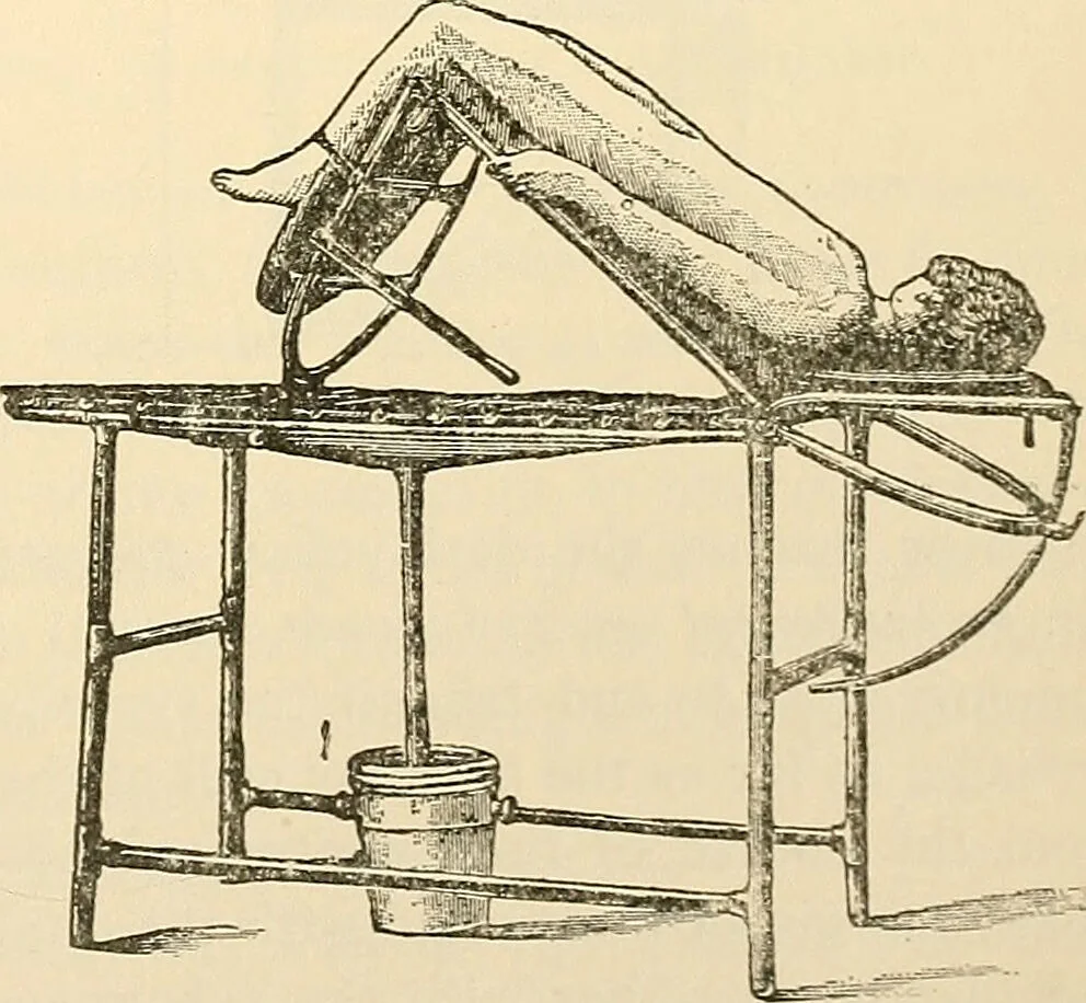 An illustration from Surgical technic; a text-book on operative surgery / by Fr. von Esmarch ... and E. Kowalzig ... translated by Professor Ludwig H. Grau ... and Willam N. Sullivan ... edited by Nicholas Senn ... With fourteen hundred and ninety-seven illustrations and fifteen colored plates., 1901, leaf 847