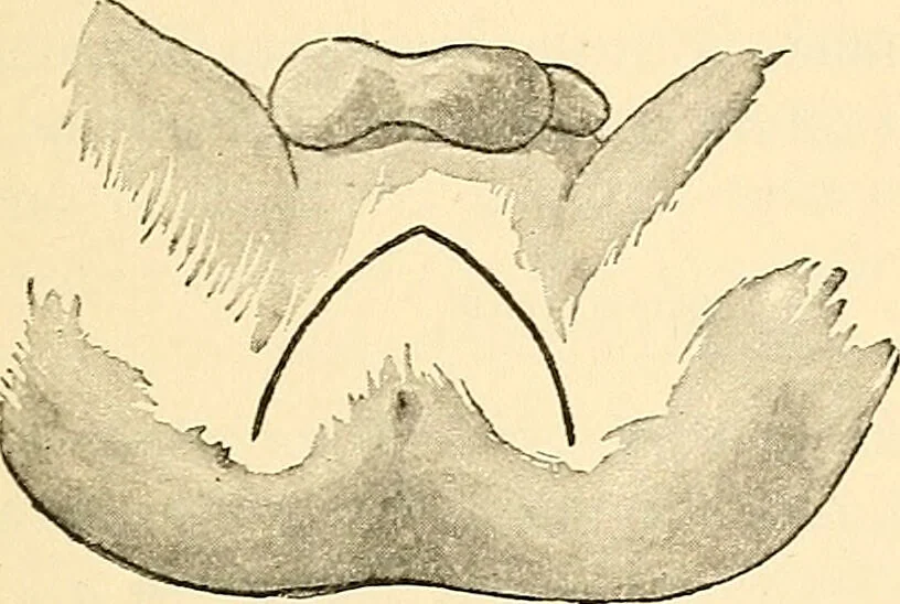 An illustration from Surgical technic; a text-book on operative surgery / by Fr. von Esmarch ... and E. Kowalzig ... translated by Professor Ludwig H. Grau ... and Willam N. Sullivan ... edited by Nicholas Senn ... With fourteen hundred and ninety-seven illustrations and fifteen colored plates., 1901, leaf 857