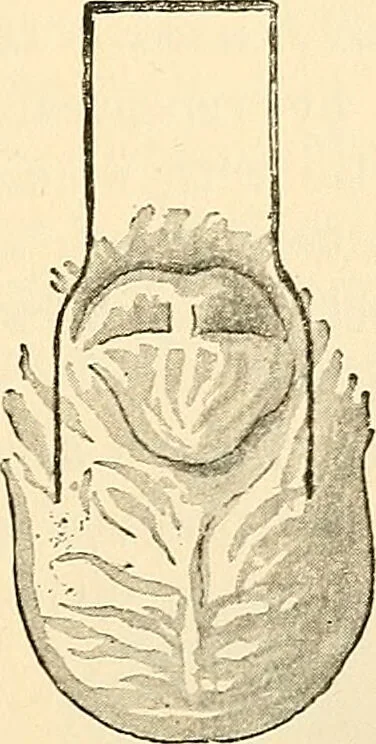 An illustration from Surgical technic; a text-book on operative surgery / by Fr. von Esmarch ... and E. Kowalzig ... translated by Professor Ludwig H. Grau ... and Willam N. Sullivan ... edited by Nicholas Senn ... With fourteen hundred and ninety-seven illustrations and fifteen colored plates., 1901, leaf 867