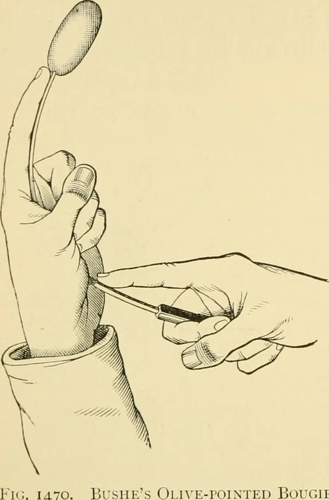 An illustration from Surgical technic; a text-book on operative surgery / by Fr. von Esmarch ... and E. Kowalzig ... translated by Professor Ludwig H. Grau ... and Willam N. Sullivan ... edited by Nicholas Senn ... With fourteen hundred and ninety-seven illustrations and fifteen colored plates., 1901, leaf 884