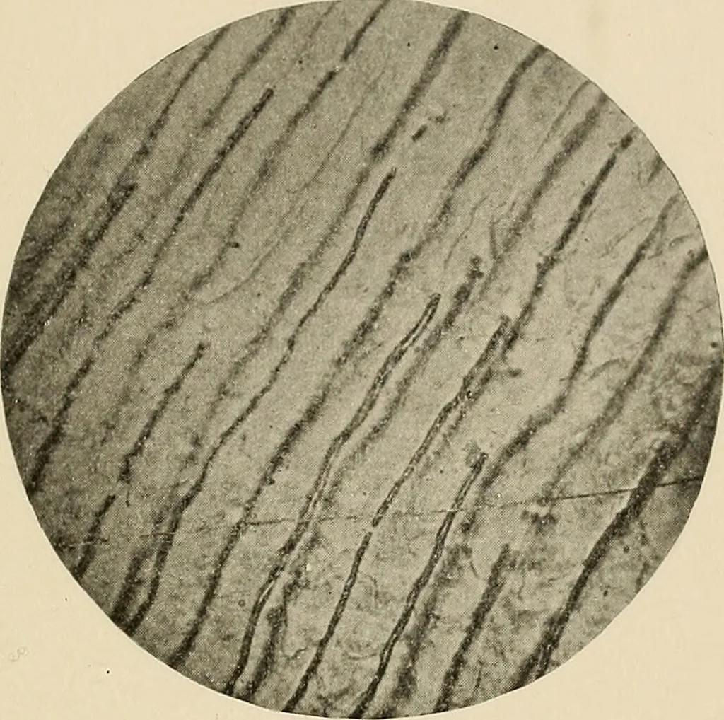 An illustration from The practice of dental medicine / By George F. Eames. Containing thirty-eight engravings and three colored plates., 1899, leaf 169