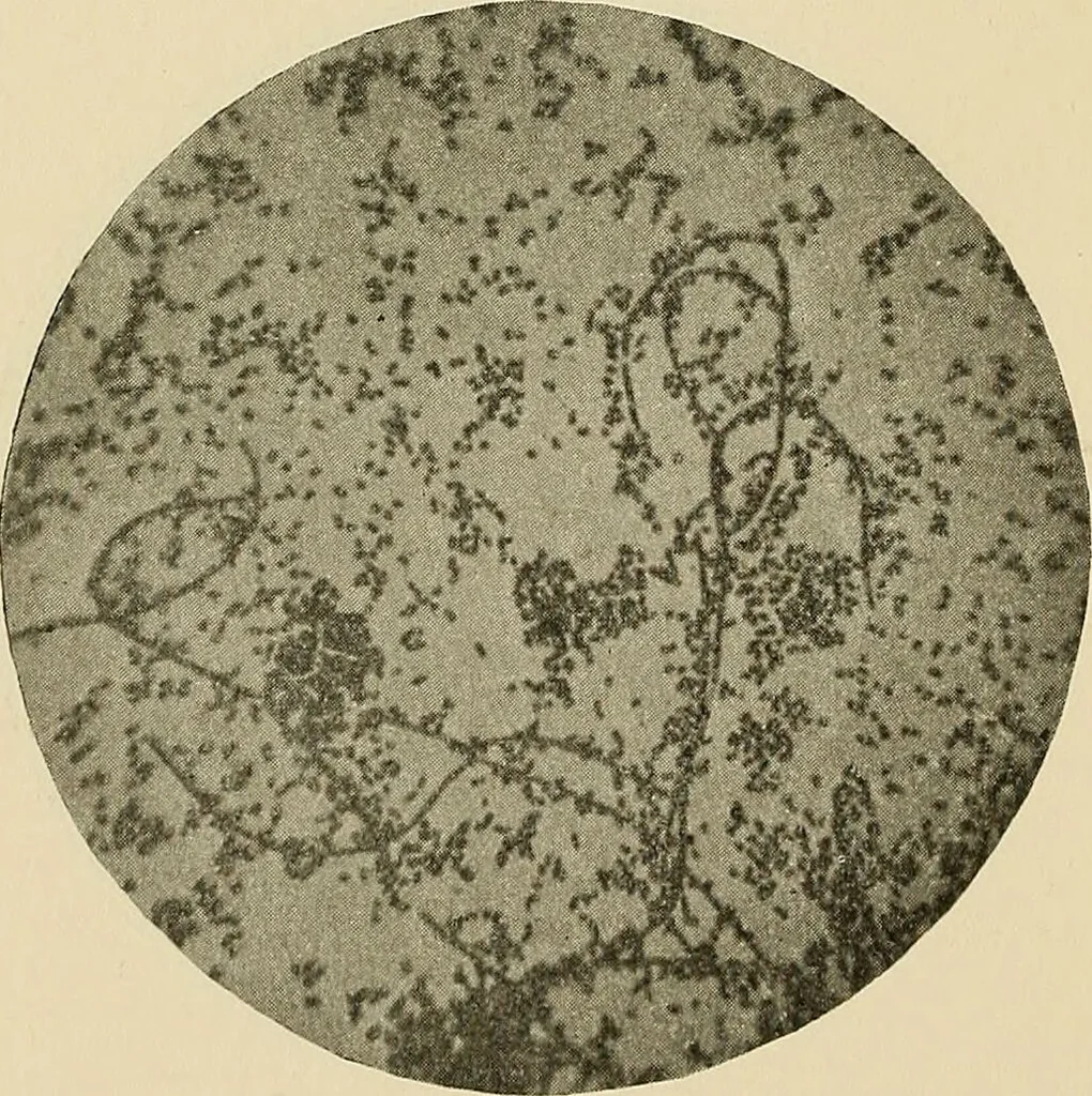 An illustration from The practice of dental medicine / By George F. Eames. Containing thirty-eight engravings and three colored plates., 1899, leaf 172