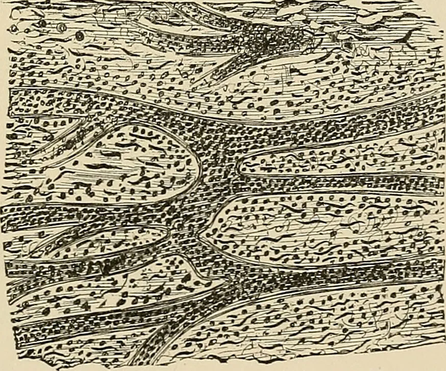 An illustration from The practice of dental medicine / By George F. Eames. Containing thirty-eight engravings and three colored plates., 1899, leaf 189