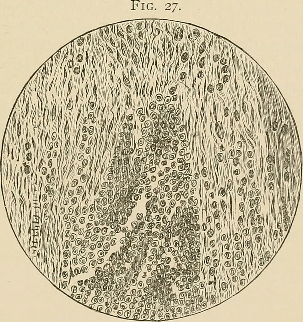 An illustration from The practice of dental medicine / By George F. Eames. Containing thirty-eight engravings and three colored plates., 1899, leaf 195