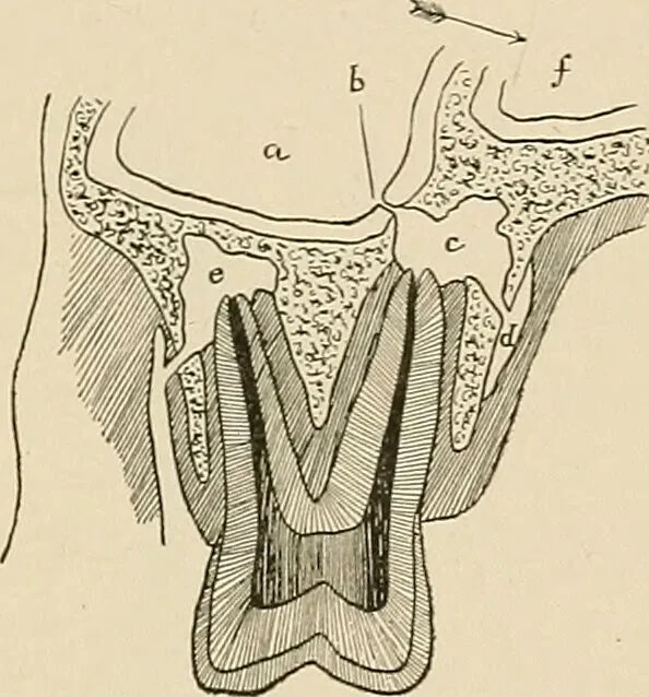 An illustration from The practice of dental medicine / By George F. Eames. Containing thirty-eight engravings and three colored plates., 1899, leaf 201