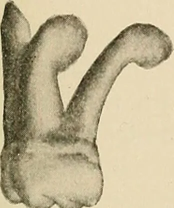 An illustration from The practice of dental medicine / By George F. Eames. Containing thirty-eight engravings and three colored plates., 1899, leaf 213