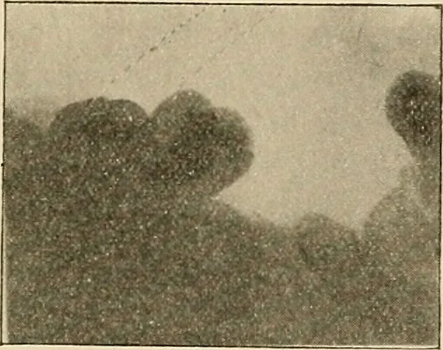 An illustration from The practice of dental medicine / By George F. Eames. Containing thirty-eight engravings and three colored plates., 1899, leaf 219