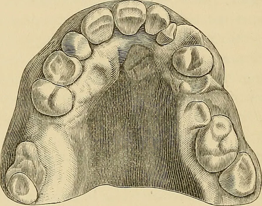 An illustration from The practice of dental medicine / By George F. Eames. Containing thirty-eight engravings and three colored plates., 1899, leaf 246