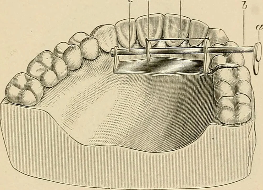 An illustration from The practice of dental medicine / By George F. Eames. Containing thirty-eight engravings and three colored plates., 1899, leaf 247