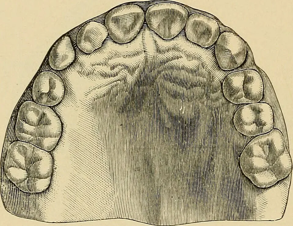 An illustration from The practice of dental medicine / By George F. Eames. Containing thirty-eight engravings and three colored plates., 1899, leaf 248