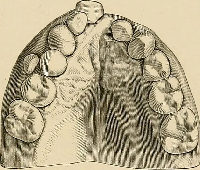 An illustration from The practice of dental medicine / By George F. Eames. Containing thirty-eight engravings and three colored plates., 1899, leaf 249