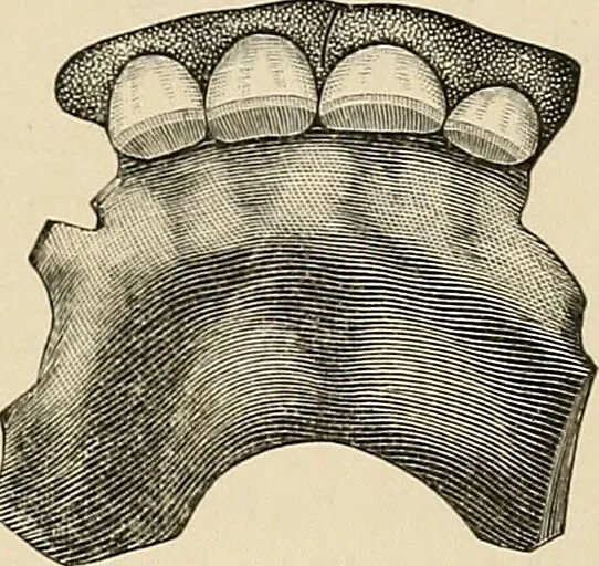 An illustration from The practice of dental medicine / By George F. Eames. Containing thirty-eight engravings and three colored plates., 1899, leaf 81