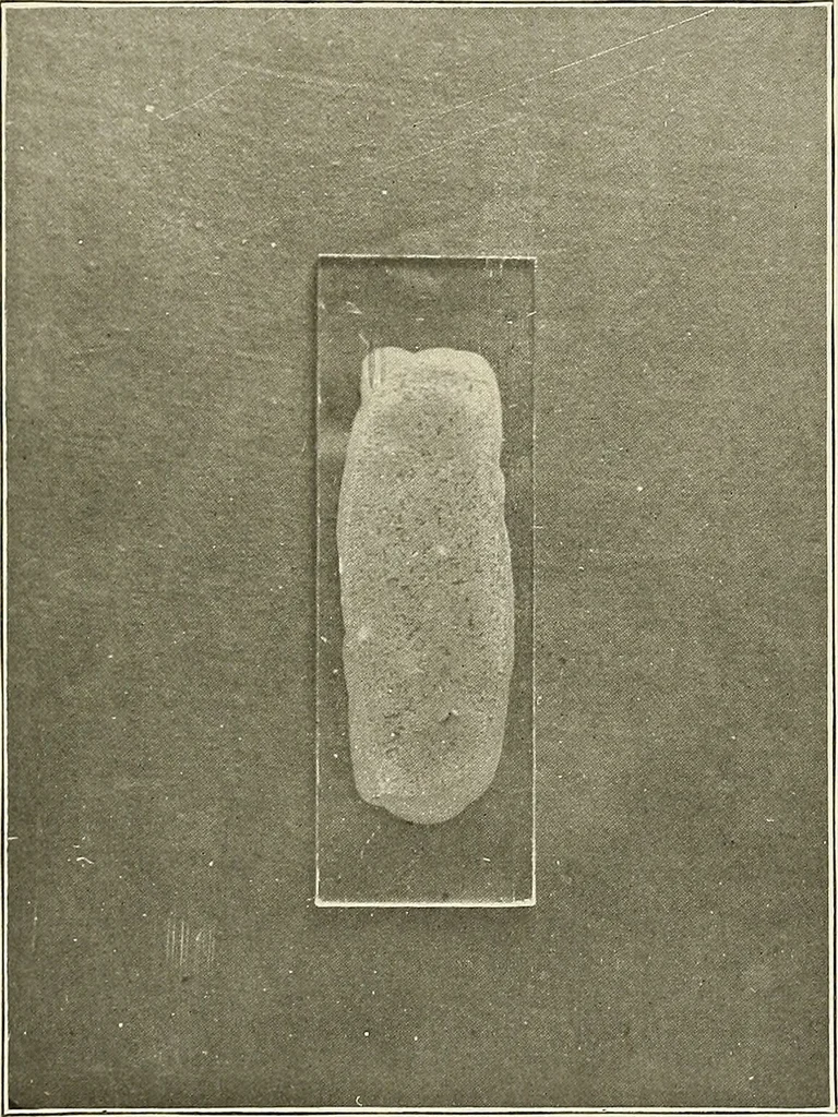 An illustration from Hookworm disease : etiology, pathology, diagnosis, prognosis, prophylaxis, and treatment / by George Dock and Charles C. Bass. Illustrated with forty-nine special engravings and colored plate., 1910, leaf 165
