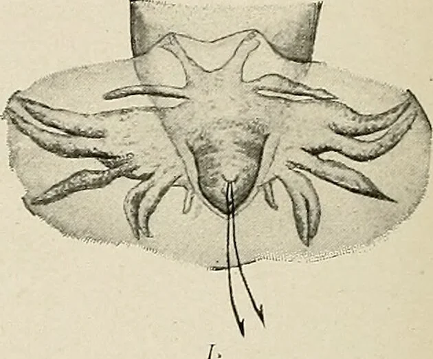 An illustration from Hookworm disease : etiology, pathology, diagnosis, prognosis, prophylaxis, and treatment / by George Dock and Charles C. Bass. Illustrated with forty-nine special engravings and colored plate., 1910, leaf 64
